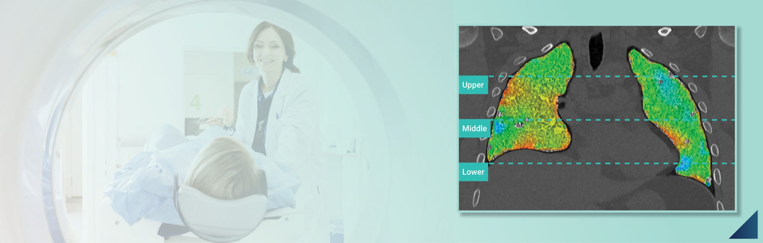 Ct Lvas Regional Lung Function Imaging Software Dmedical