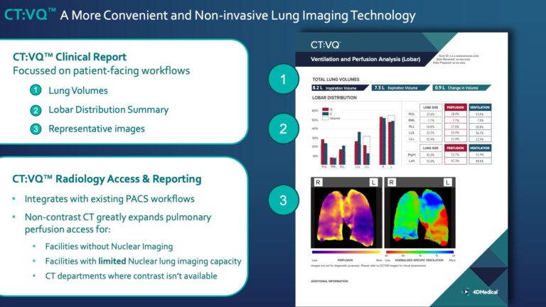 4DMedical CT:VQ® - Report Highlights
