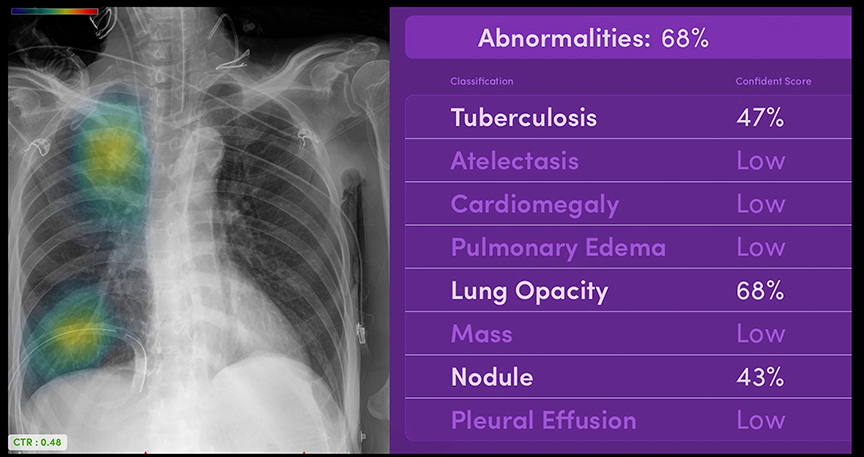 Radiology Report