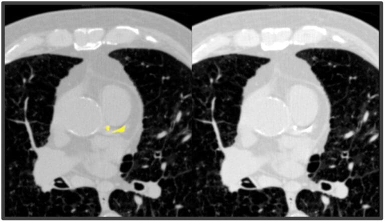 Direct routing to PACS for immediate review and integration
into clinical workflow