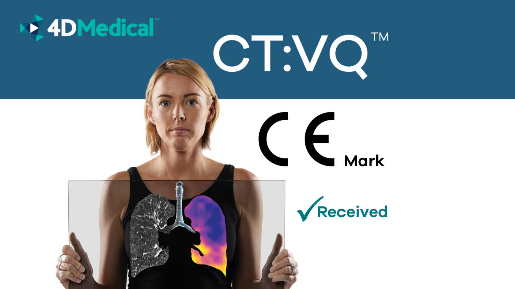 4DMedical’s CT:VQ™ technology combines the anatomical clarity of CT with functional ventilation-perfusion mapping from routine non-contrast CT scans, giving clinicians quantitative insights into regional lung function without radiotracers.